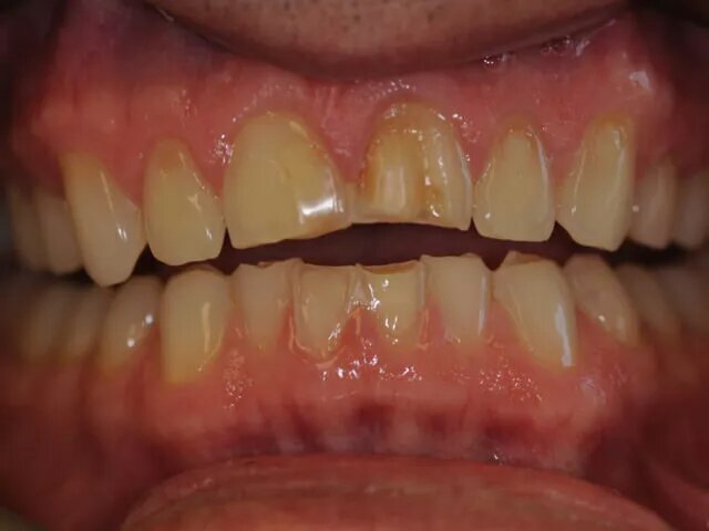 Moffitt Dental Moffitt Dental