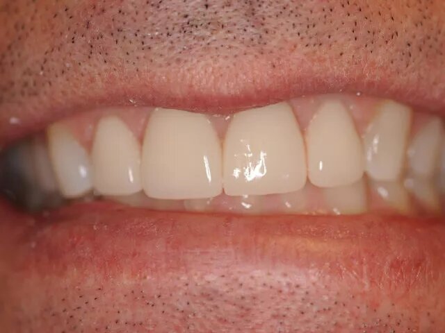 Moffitt Dental Moffitt Dental