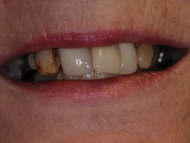 Moffitt Dental Moffitt Dental