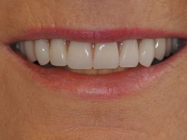 Moffitt Dental Moffitt Dental