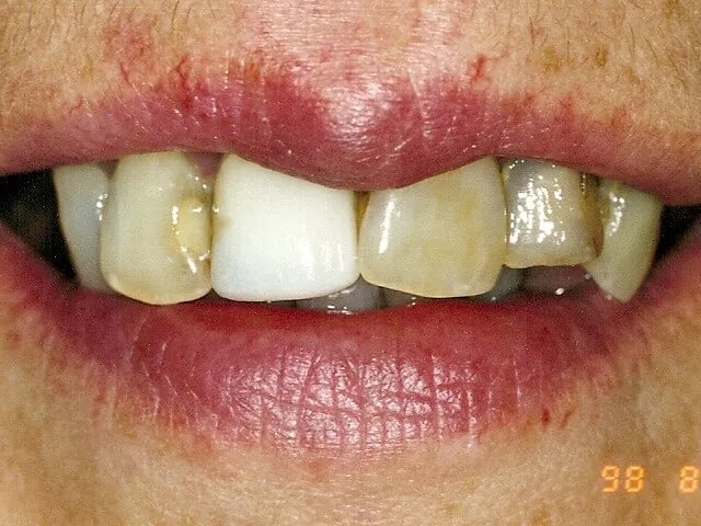 Moffitt Dental Moffitt Dental