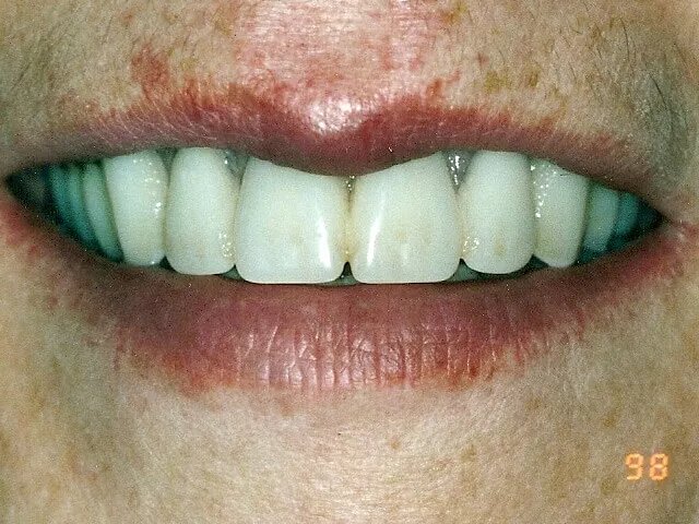 Moffitt Dental Moffitt Dental