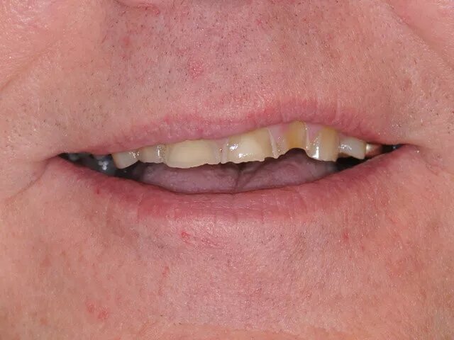 Moffitt Dental Moffitt Dental