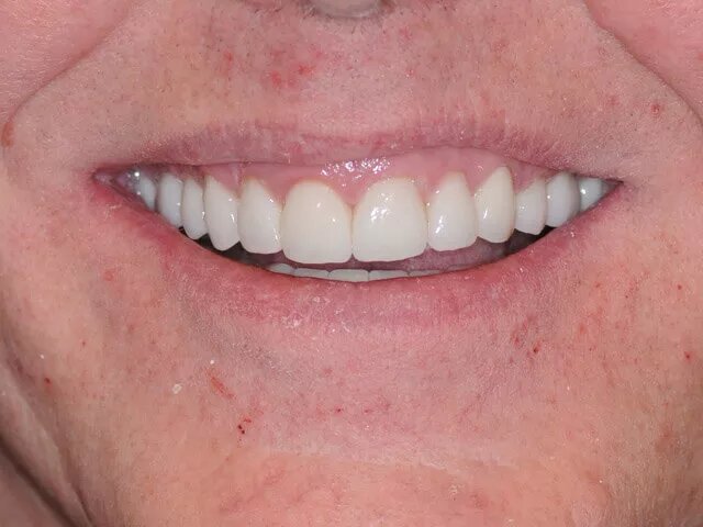 Moffitt Dental Moffitt Dental