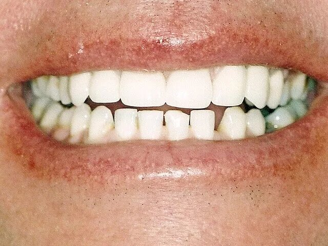 Moffitt Dental Moffitt Dental