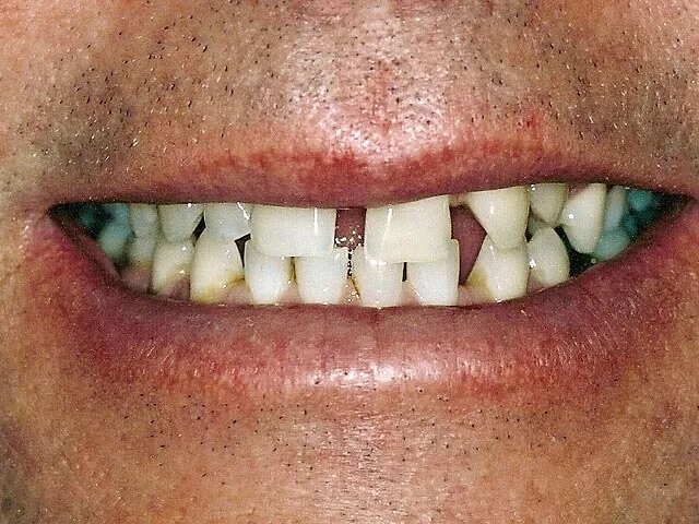 Moffitt Dental Moffitt Dental