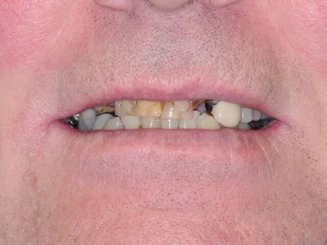 Moffitt Dental Moffitt Dental