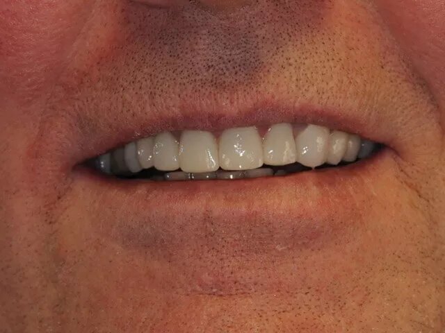 Moffitt Dental Moffitt Dental