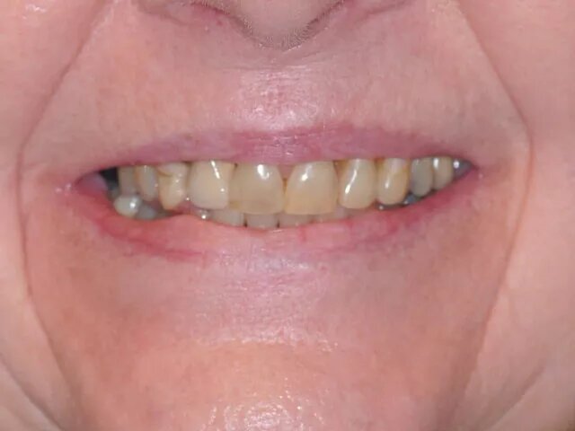 Moffitt Dental Moffitt Dental