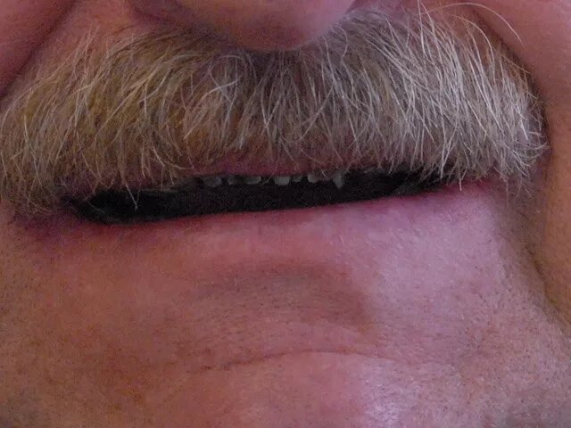 Moffitt Dental Moffitt Dental