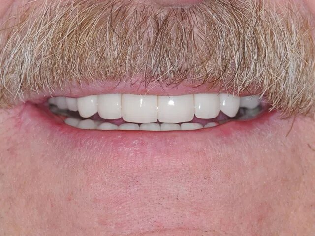 Moffitt Dental Moffitt Dental