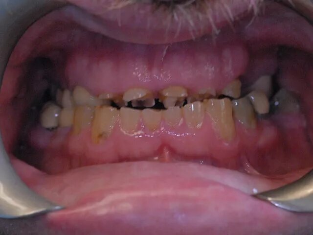 Moffitt Dental Moffitt Dental