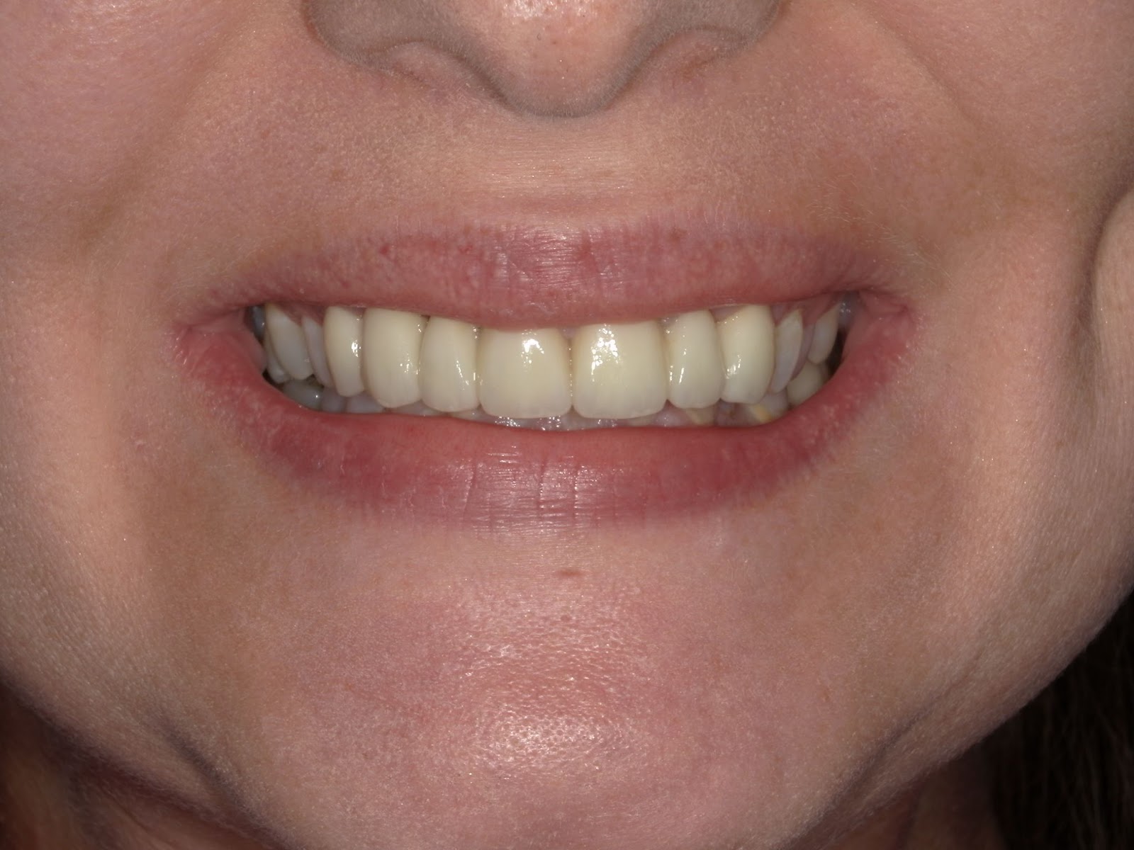 Moffitt Dental Moffitt Dental
