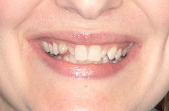 Moffitt Dental Moffitt Dental
