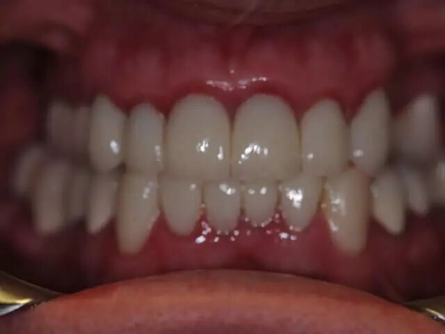 Moffitt Dental Moffitt Dental