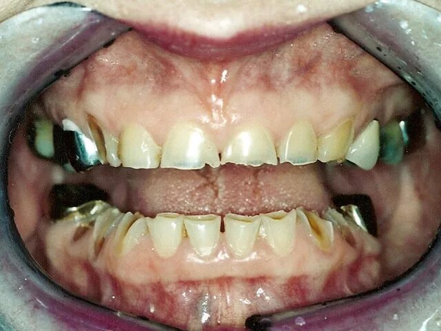 Moffitt Dental Moffitt Dental