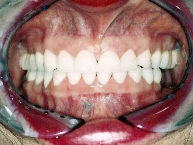 Moffitt Dental Moffitt Dental