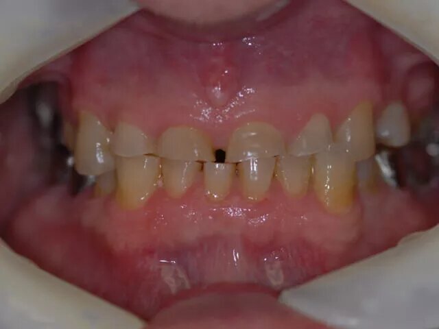 Moffitt Dental Moffitt Dental