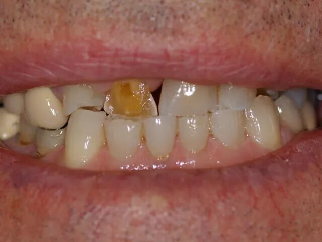 Moffitt Dental Moffitt Dental