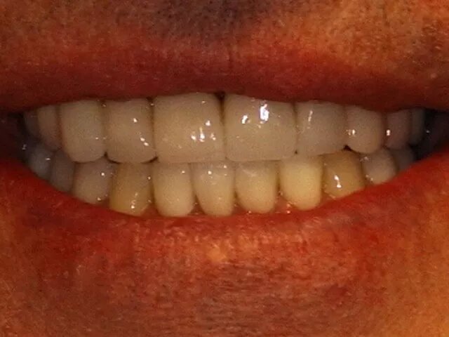 Moffitt Dental Moffitt Dental