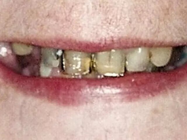 Moffitt Dental Moffitt Dental