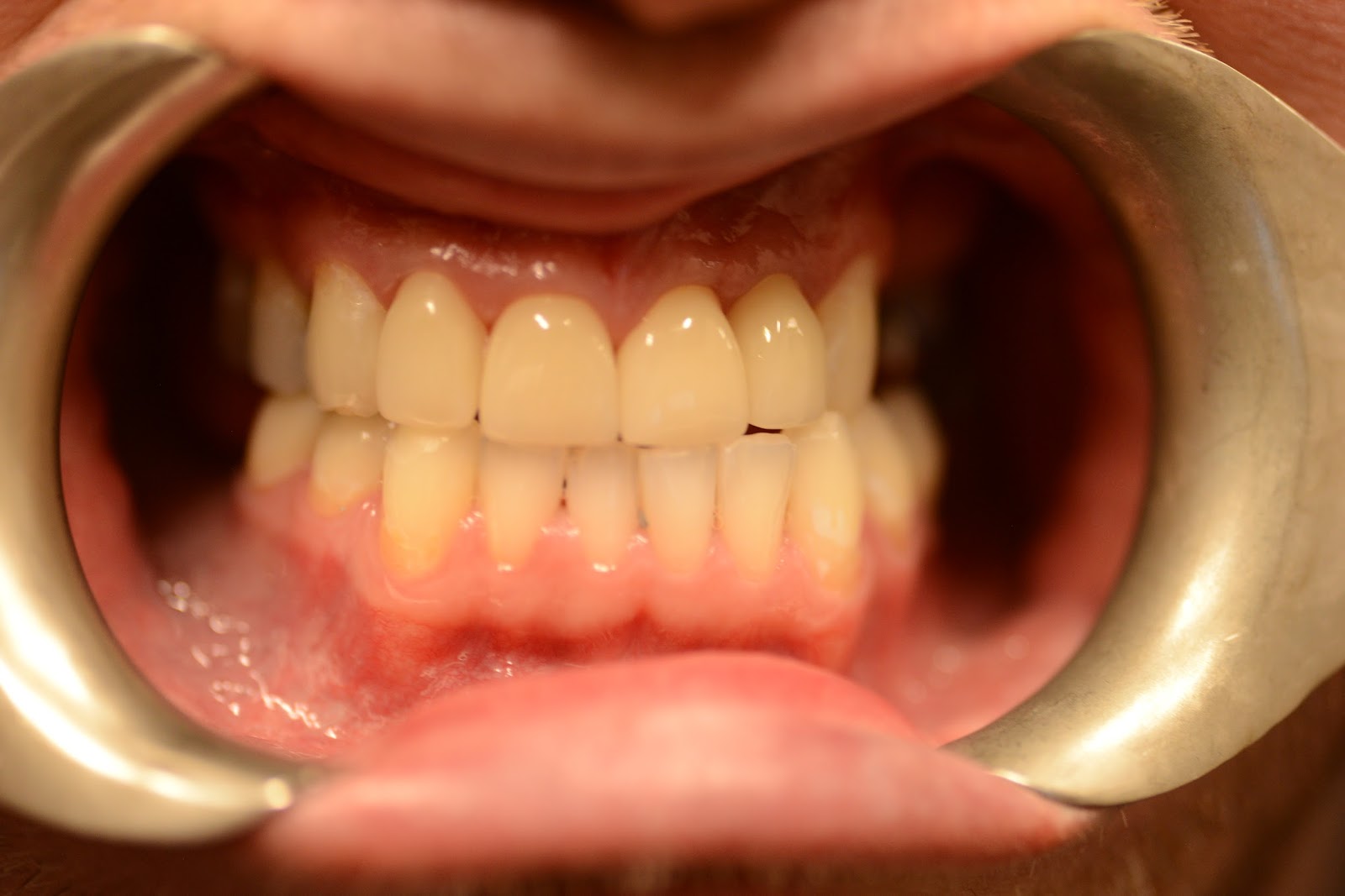 Moffitt Dental Moffitt Dental