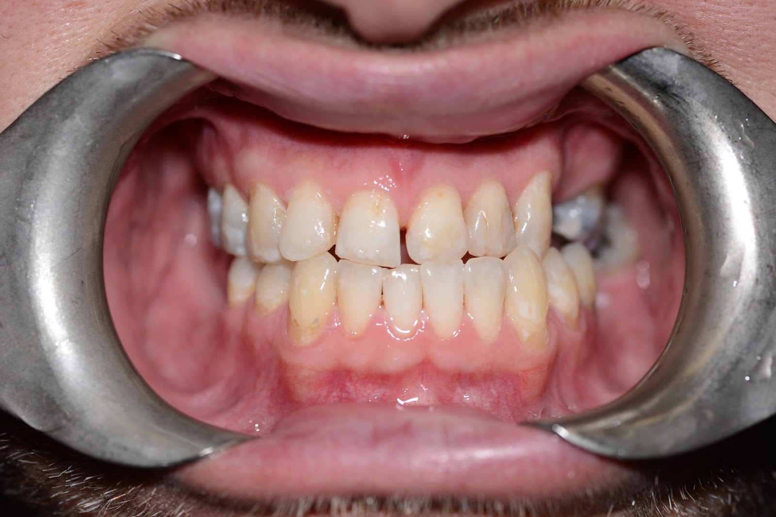 Moffitt Dental Moffitt Dental