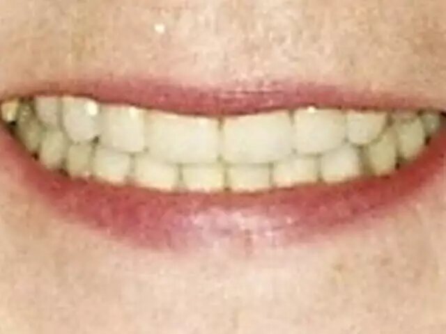 Moffitt Dental Moffitt Dental