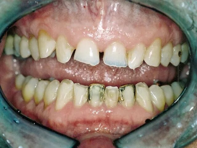 Moffitt Dental Moffitt Dental