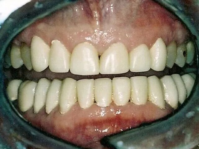 Moffitt Dental Moffitt Dental