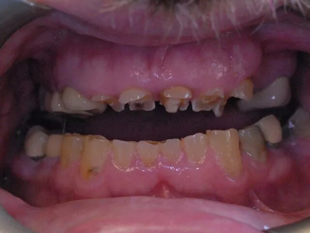 Moffitt Dental Moffitt Dental