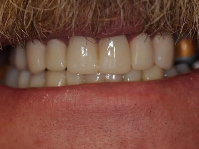 Moffitt Dental Moffitt Dental