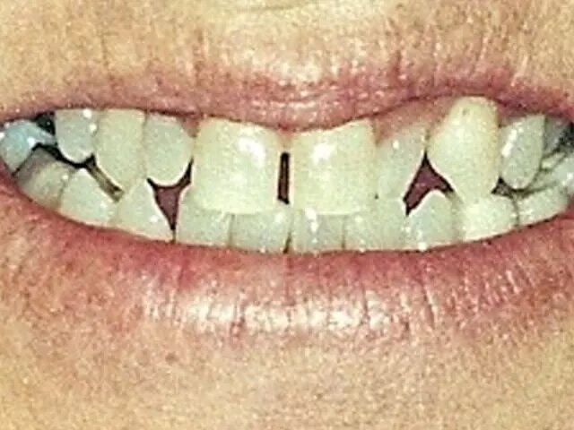 Moffitt Dental Moffitt Dental