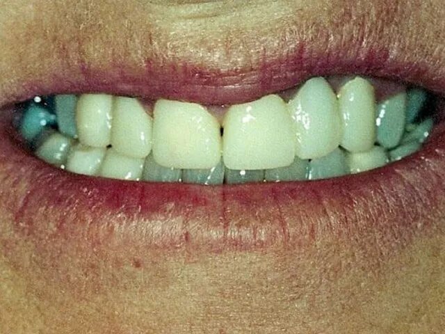 Moffitt Dental Moffitt Dental