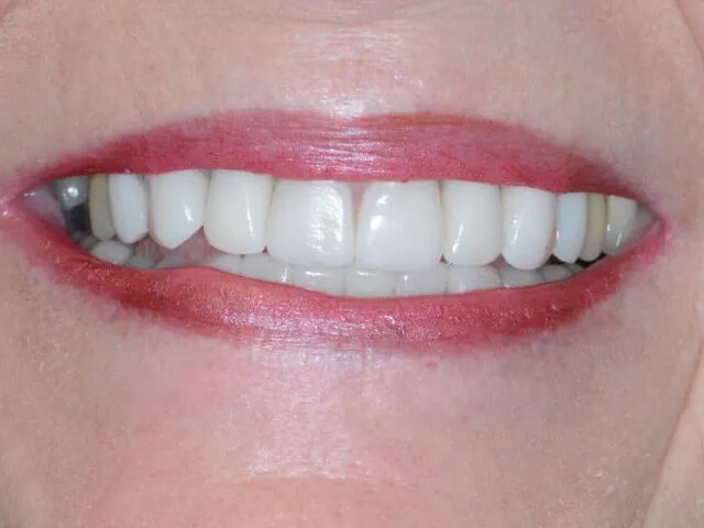 Moffitt Dental Moffitt Dental