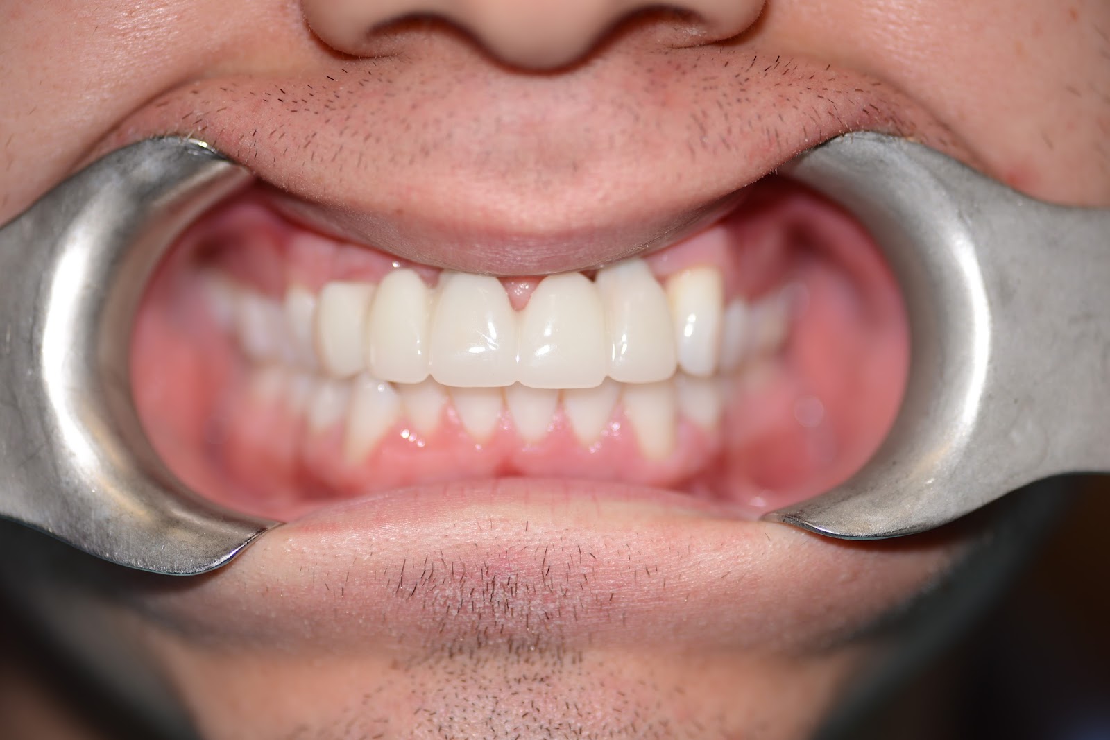 Moffitt Dental Moffitt Dental