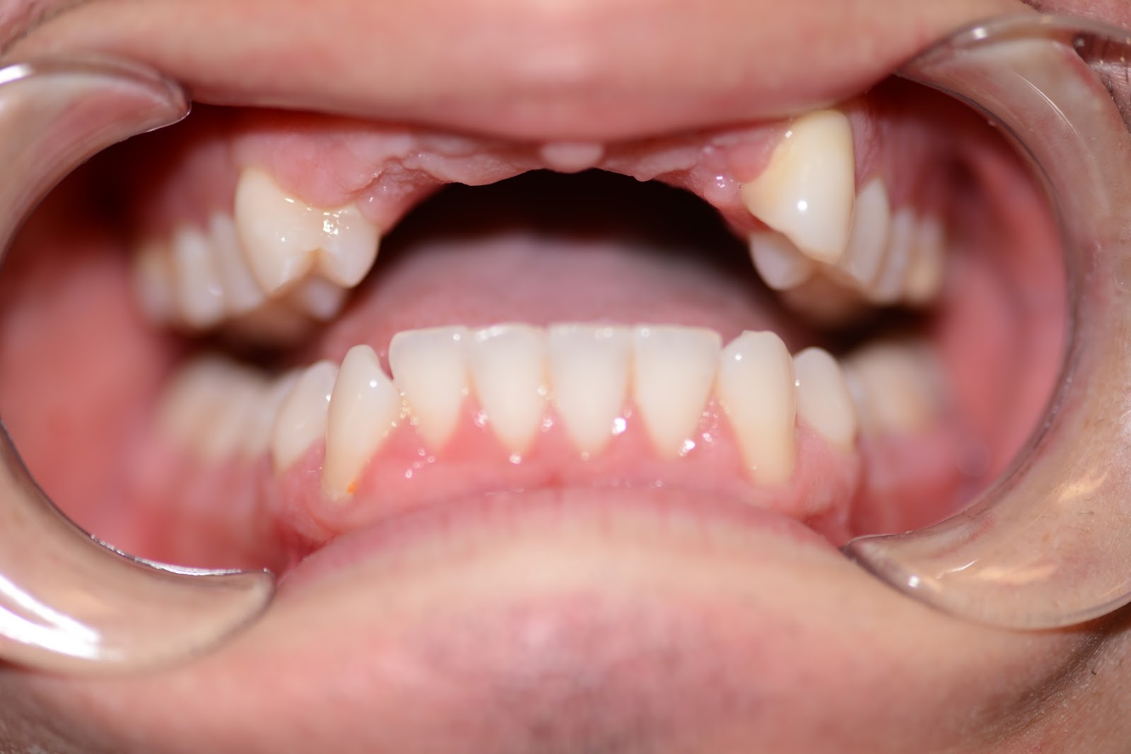 Moffitt Dental Moffitt Dental