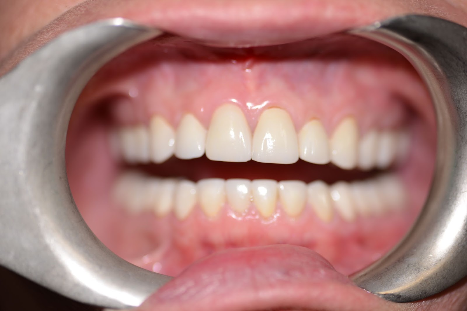 Moffitt Dental Moffitt Dental