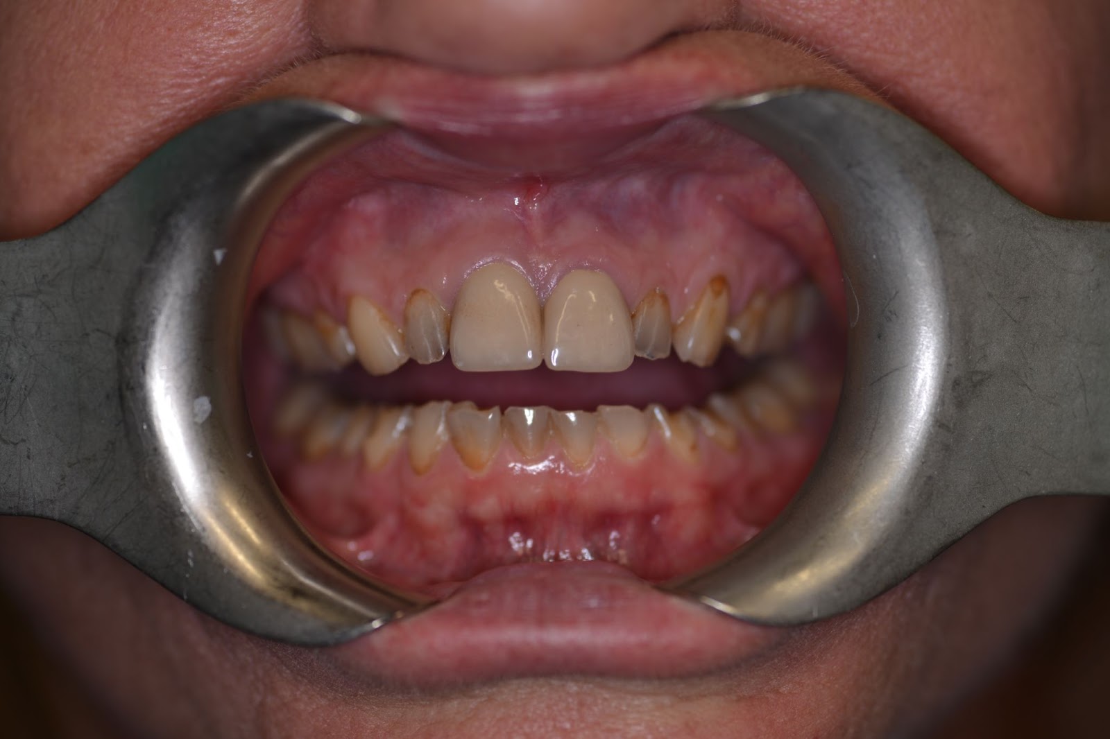 Moffitt Dental Moffitt Dental
