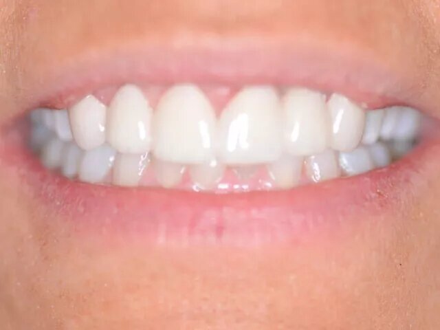 Moffitt Dental Moffitt Dental