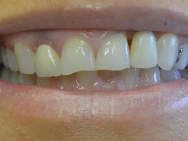 Moffitt Dental Moffitt Dental