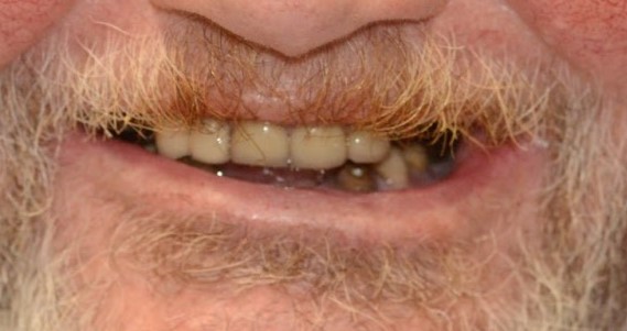 Moffitt Dental Moffitt Dental