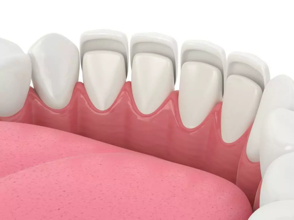 Moffitt Dental Moffitt Dental