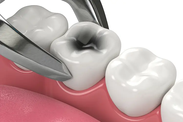 Moffitt Dental Moffitt Dental